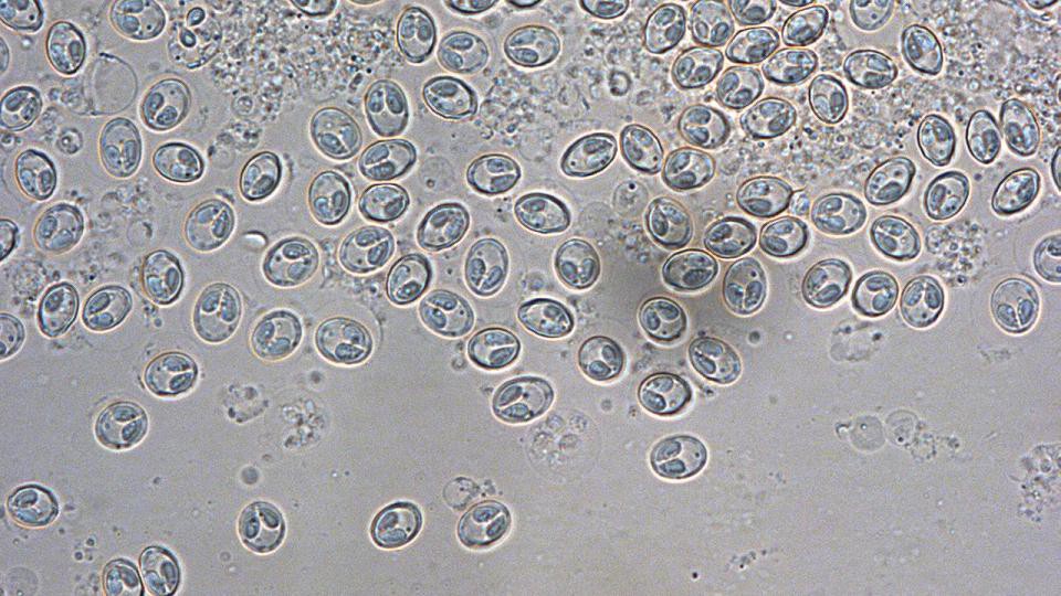 Myxobolus portucalensis Sporen (c) Klaus Knopf